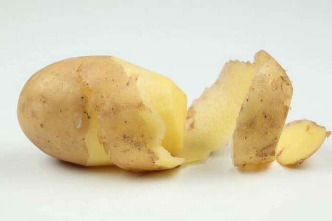 bulvės gimdos kaklelio osteochondrozei gydyti