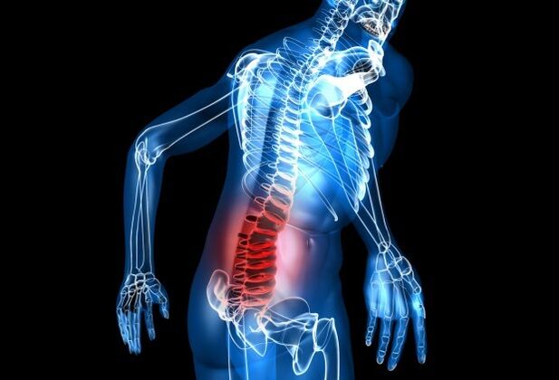Osteochondrozės simptomai